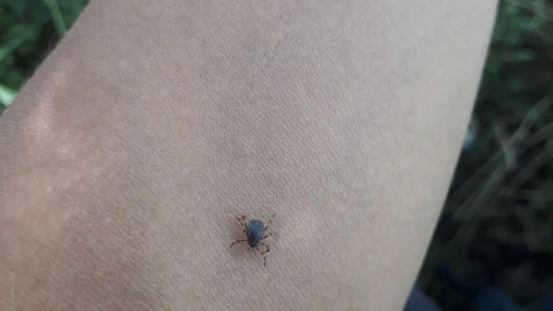 Kene çıkarırken yapılan hatalar Bunları yapmayın!