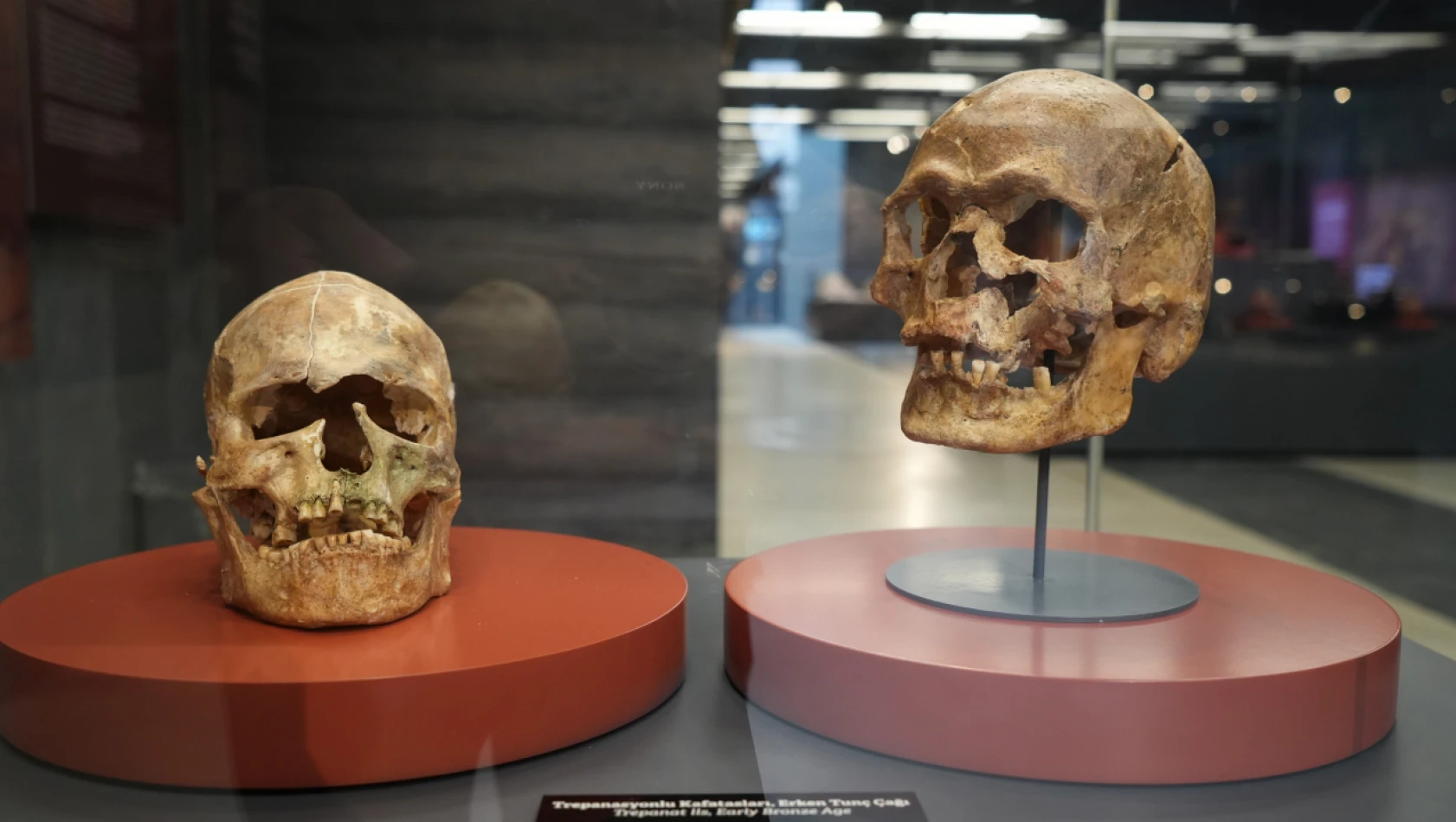5 bin yıllık ameliyatlı kafataslarının bulunduğu müze, açılacak gün sayıyor.