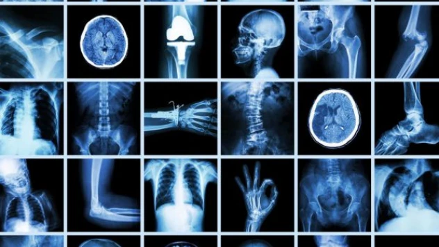 Gereksiz radyolojik tetkiklerden kaçınılmalı