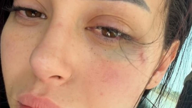 GKRY'de 25 yaşındaki Türk kızına saldıran 2 Rum tutuklandı