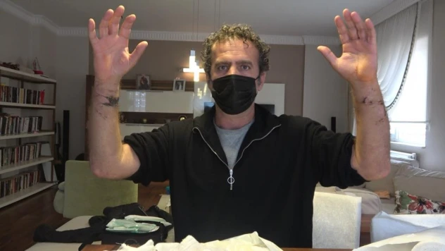 Pitbullu saldırıya uğradı...Kolları parçalandı, ölümden döndü