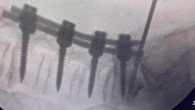 Türk doktor, bulduğu yöntemle literatüre girdi