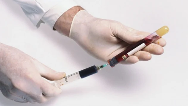 Uzmanlardan uyarı: &quot2 dakikada 1 kişiyi öldürüyor, lütfen tarama testi yaptırın&quot