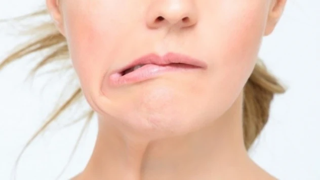 Yüz felcine karşı uzmanından öneriler