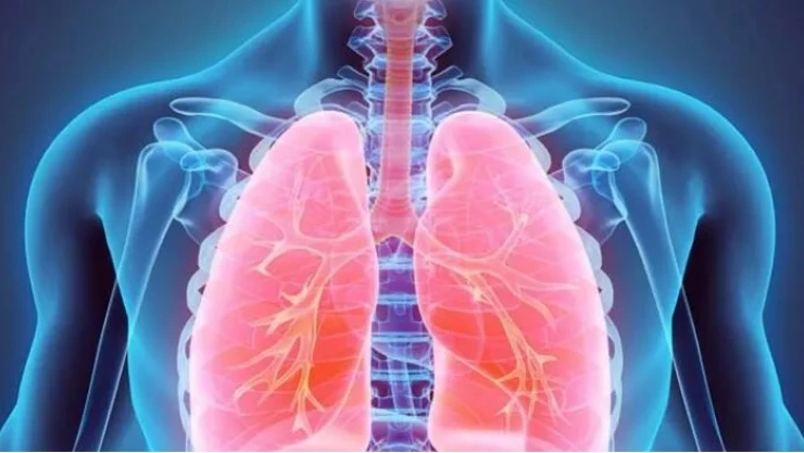 Akciğer kanseri vak'alarında yüz güldürücü sonuç