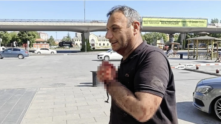 Gelenek bozulmadı: Acemi kasaplar hastaneye koştu