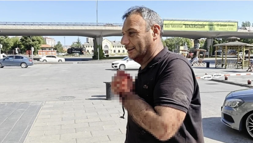 Gelenek bozulmadı: Acemi kasaplar hastaneye koştu