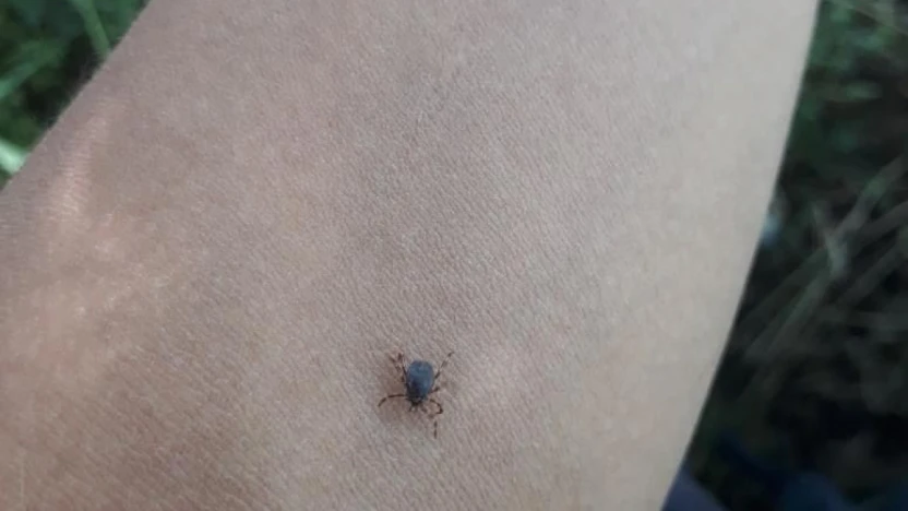 Kene çıkarırken yapılan hatalar Bunları yapmayın!